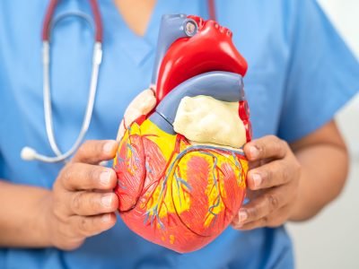 Cardiovascular disease CVD, Asian doctor holding human anatomy model for learn and treat heart disease.